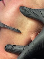 Dermaplaning Blade